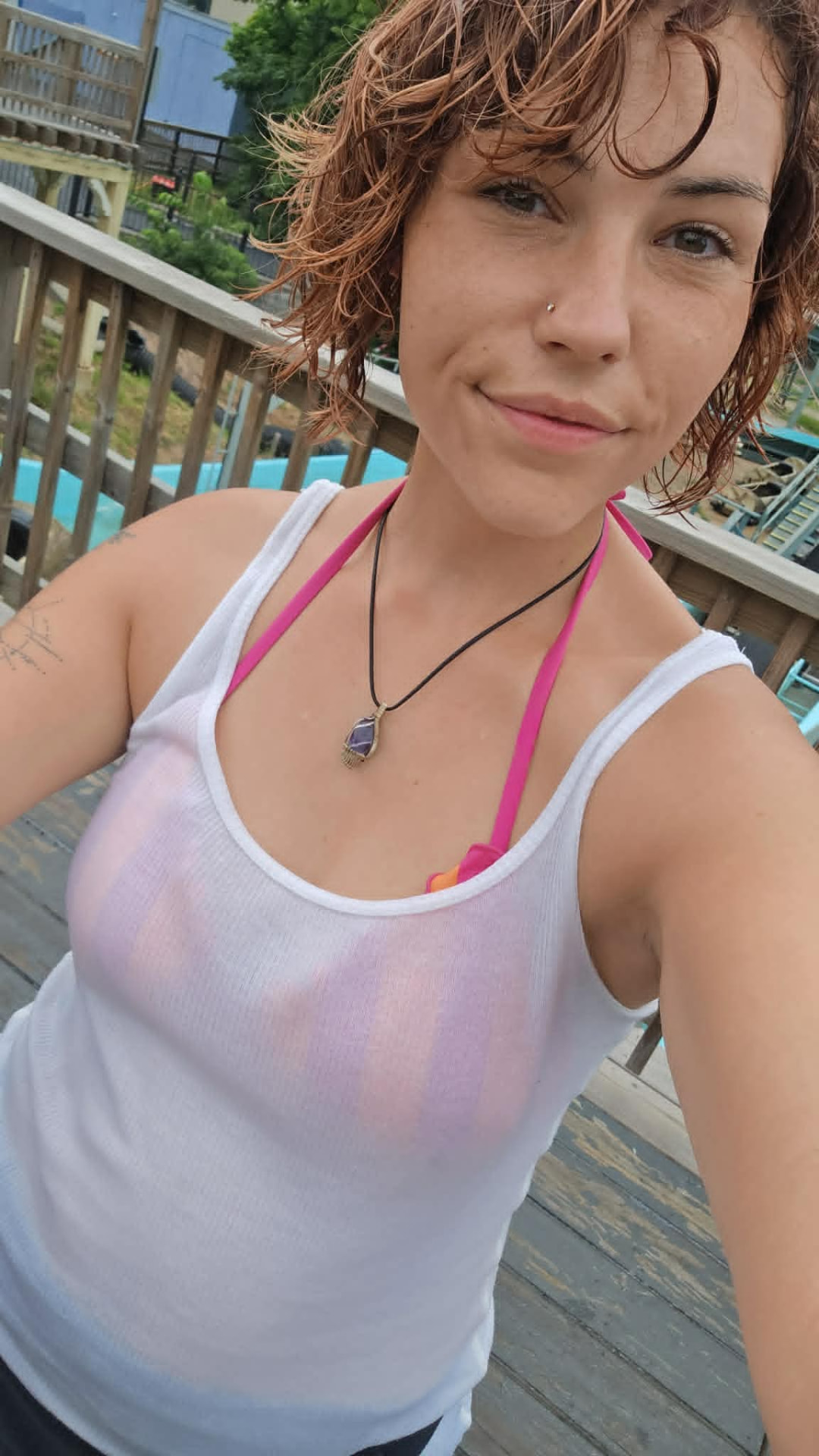 KAYLA R. before